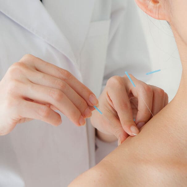 acupuncturist