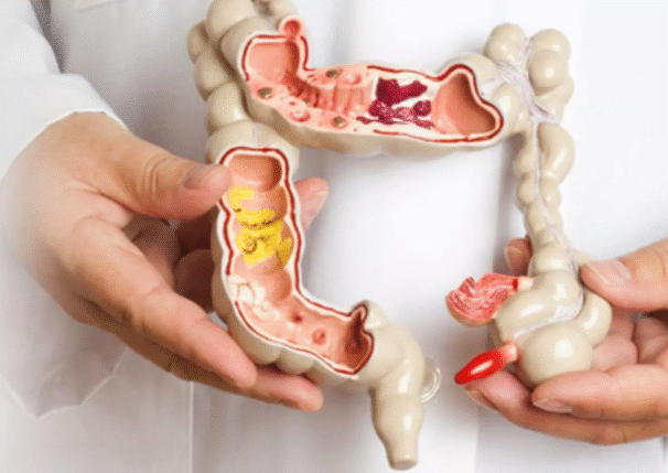 Colon & Rectal Surgeon