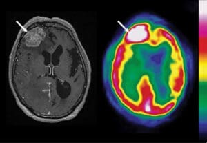 Diagnostic Neuroimaging Psychiatry & Neurology Physician