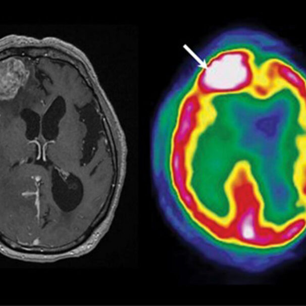 Diagnostic Neuroimaging Psychiatry & Neurology Physician