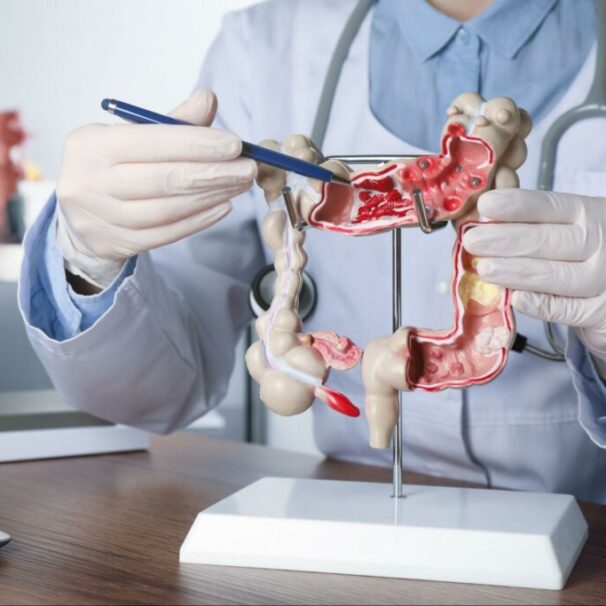 Gastroenterology Physician