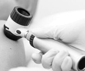 Procedural Dermatology