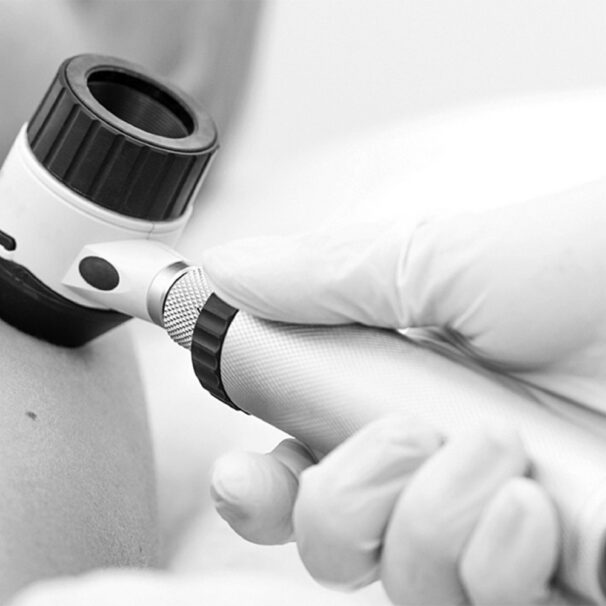 Procedural Dermatology