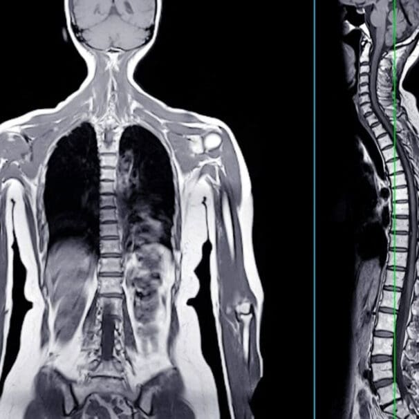 Body Imaging Physicians