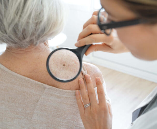 Dermatologist