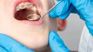 Orthodontics and Dentofacial Orthopedics Dentistry