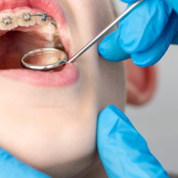 Orthodontics and Dentofacial Orthopedics Dentistry