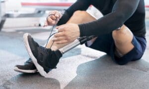 Prosthetics Case Management