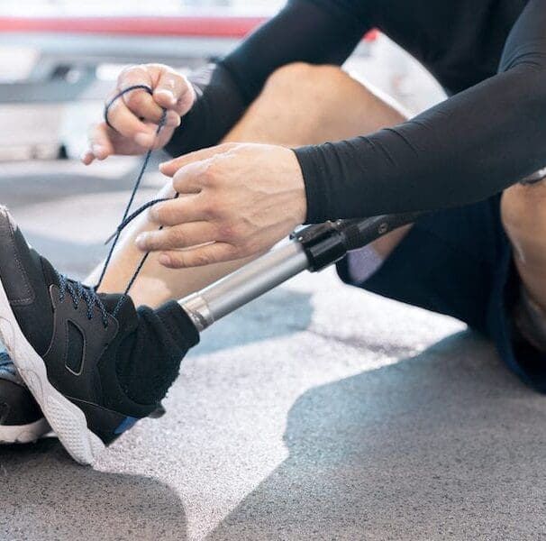 Prosthetics Case Management