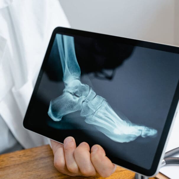 Radiology Podiatrists